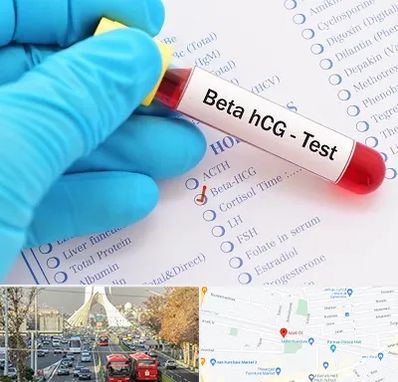 آزمایشگاه بارداری در خیابان آزادی 