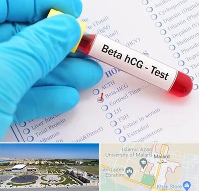 آزمایشگاه بارداری در ملارد