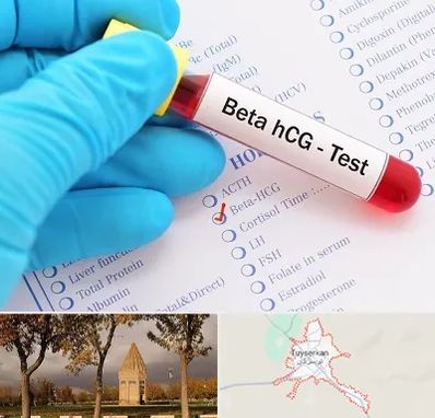 آزمایشگاه بارداری در تویسرکان