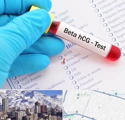 آزمایشگاه بارداری در ازگل