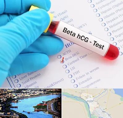 آزمایشگاه بارداری در خرمشهر