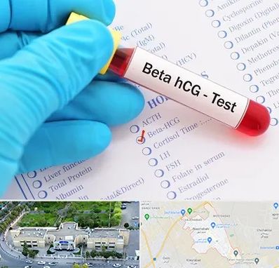 آزمایشگاه بارداری در نسیم شهر