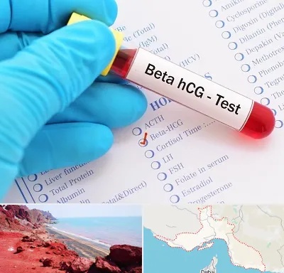 آزمایشگاه بارداری در هرمزگان