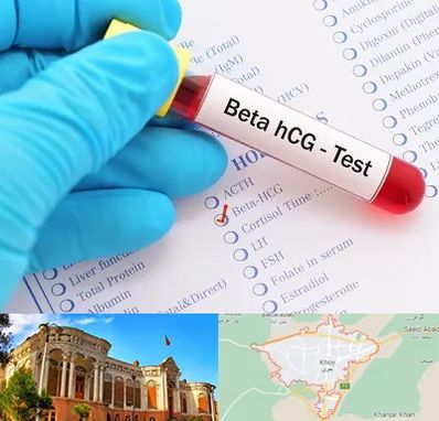 آزمایشگاه بارداری در خوی