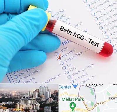 آزمایشگاه بارداری در الهیه 