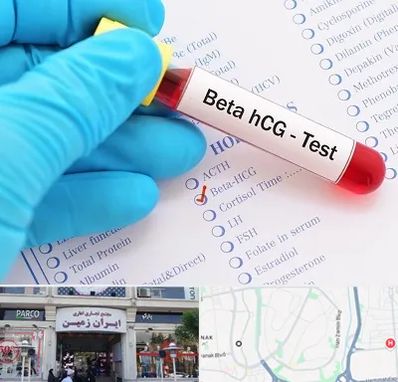 آزمایشگاه بارداری در ایران زمین