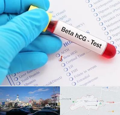 آزمایشگاه بارداری در ماهدشت کرج