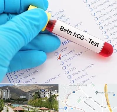 آزمایشگاه بارداری در شهر زیبا 