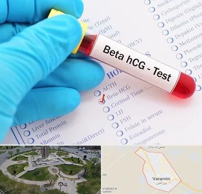 آزمایشگاه بارداری در ورامین