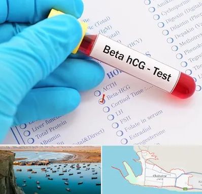 آزمایشگاه بارداری در چابهار