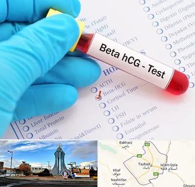 آزمایشگاه بارداری در تایباد