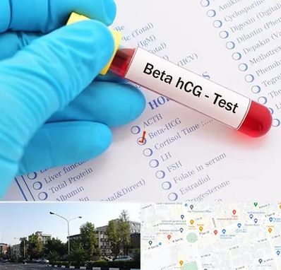 آزمایشگاه بارداری در میدان کاج 