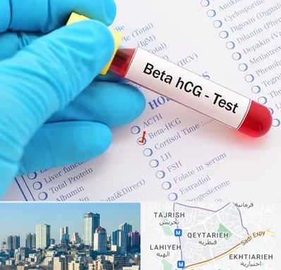 آزمایشگاه بارداری در قیطریه 