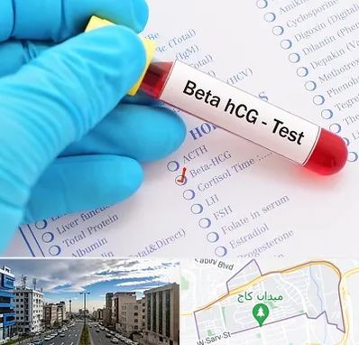 آزمایشگاه بارداری در سعادت آباد 