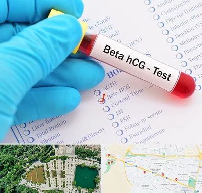 آزمایشگاه بارداری در وکیل آباد مشهد