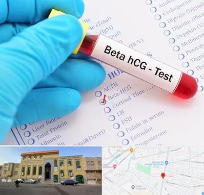 آزمایشگاه بارداری در زنبیل آباد قم