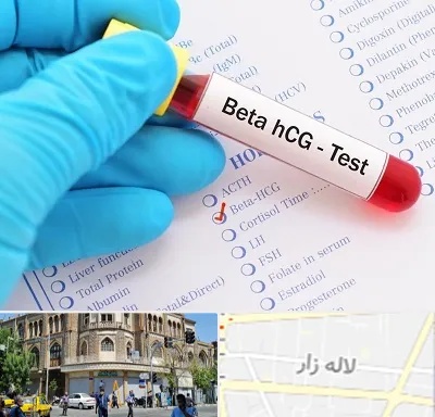 آزمایشگاه بارداری در لاله زار