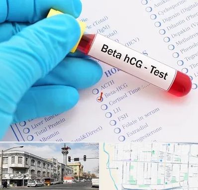 آزمایشگاه بارداری در 17شهریور