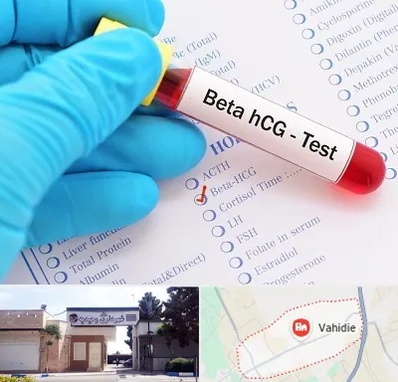 آزمایشگاه بارداری در وحیدیه شهریار