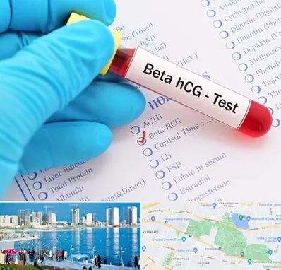 آزمایشگاه بارداری در چیتگر 