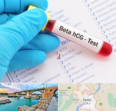 آزمایشگاه بارداری در دزفول