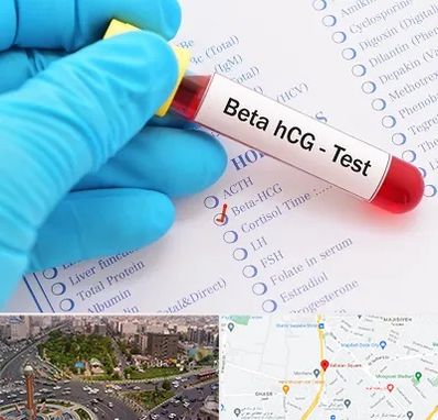 آزمایشگاه بارداری در سبلان 