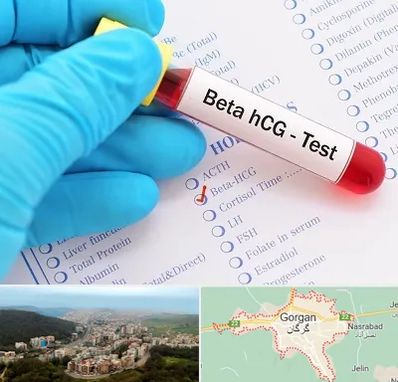 آزمایشگاه بارداری در گرگان