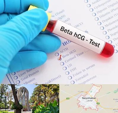 آزمایشگاه بارداری در نیشابور