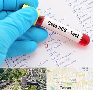 آزمایشگاه بارداری در شمال تهران 