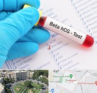 آزمایشگاه بارداری در جهانشهر کرج 