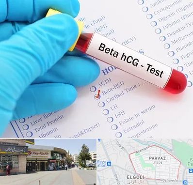 آزمایشگاه بارداری در پرواز تبریز