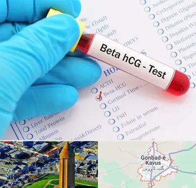 آزمایشگاه بارداری در گنبد کاووس
