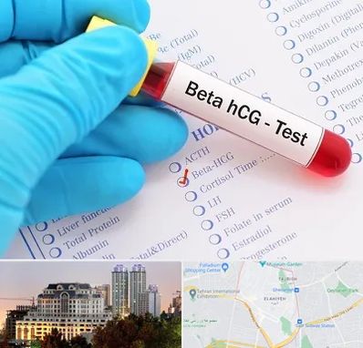 آزمایشگاه بارداری در فرشته 