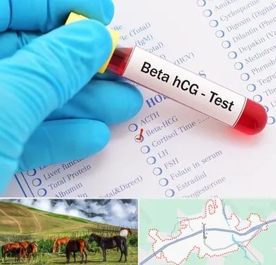 آزمایشگاه بارداری در تالش