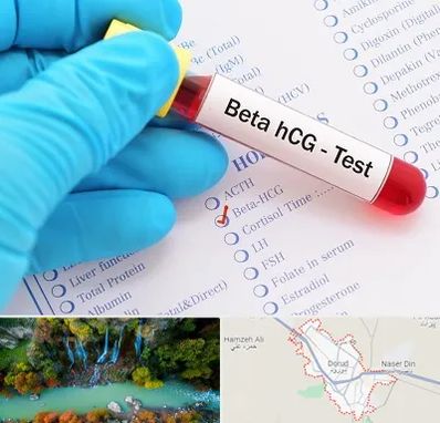 آزمایشگاه بارداری در دورود