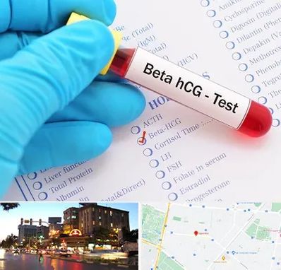 آزمایشگاه بارداری در بلوار سجاد مشهد