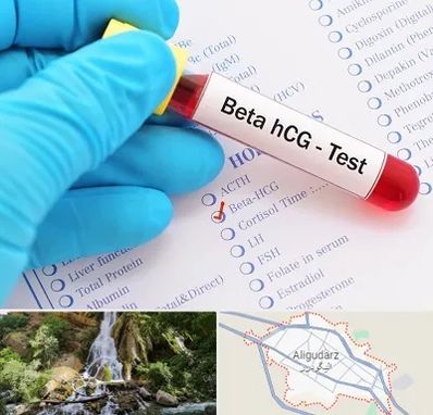 آزمایشگاه بارداری در الیگودرز