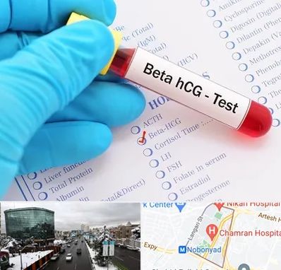 آزمایشگاه بارداری در اقدسیه 