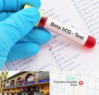 آزمایشگاه بارداری در 15 خرداد