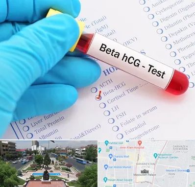 آزمایشگاه بارداری در بهارستان 