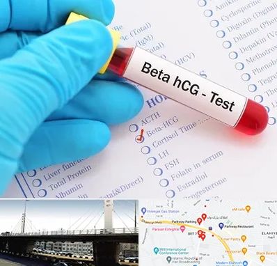 آزمایشگاه بارداری در پارک وی 