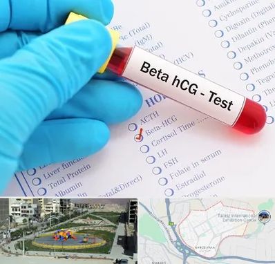 آزمایشگاه بارداری در مرزداران تبریز