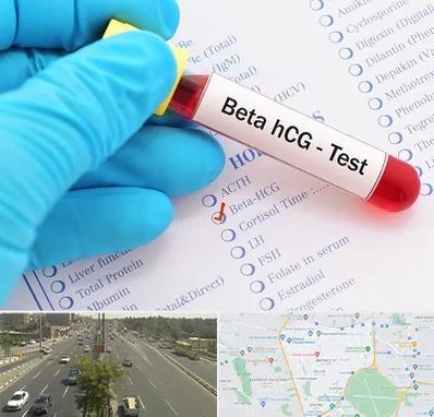 آزمایشگاه بارداری در منطقه 17 تهران 