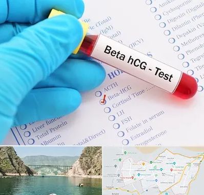 آزمایشگاه بارداری در ایلام