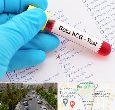 آزمایشگاه بارداری در شهران 