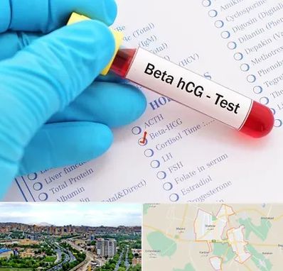 آزمایشگاه بارداری در شهریار