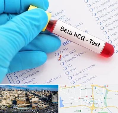 آزمایشگاه بارداری در شهرک راه آهن