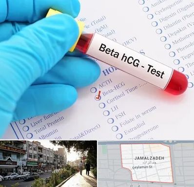 آزمایشگاه بارداری در خیابان جمالزاده