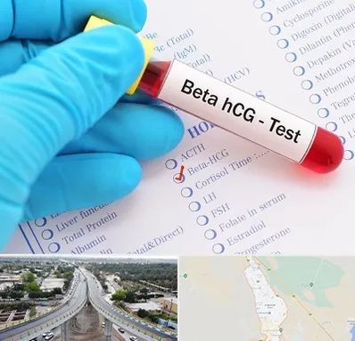 آزمایشگاه بارداری در اندیمشک