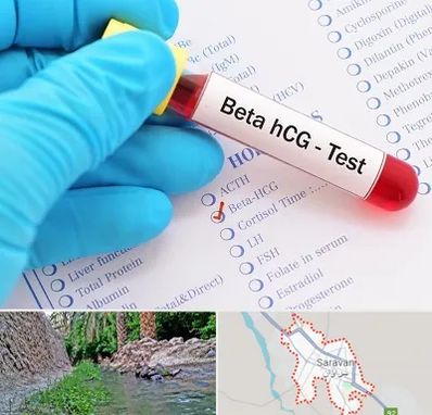 آزمایشگاه بارداری در سراوان